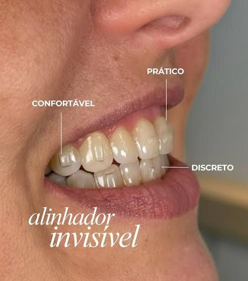 Alinhador invisível, Instituto Isaías Júnior