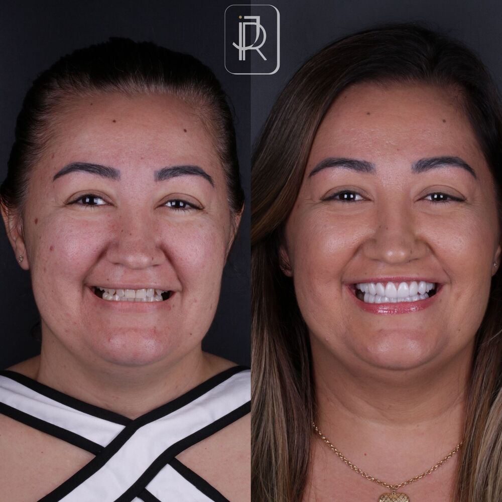 Antes e depois de caso real